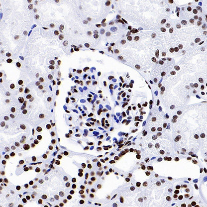 Histone H3 (acetyl K18) Recombinant Rabbit mAb (S-1688-90)