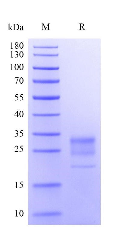 IFN-γ His Tag Protein, Human