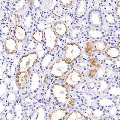 TIM-1 Recombinant Rabbit mAb (S-1555-147)