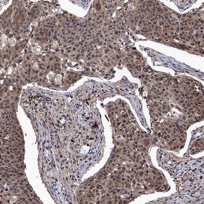 IRF3 Recombinant Rabbit mAb (S-4395)