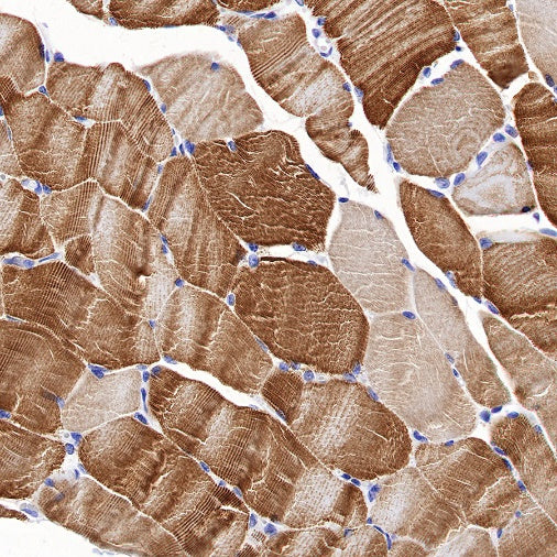 Sarcomeric Alpha Actinin Recombinant Rabbit mAb (S-1652-40)