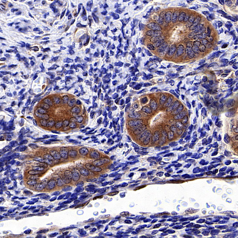 NF-kB p65 Recombinant Rabbit mAb (S-5142)