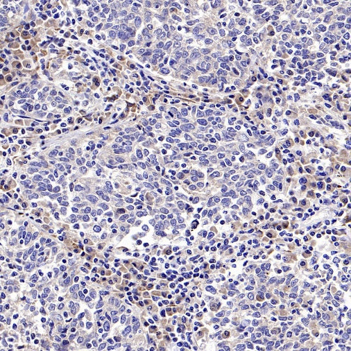 Rictor Recombinant Rabbit mAb (S-2601-26)
