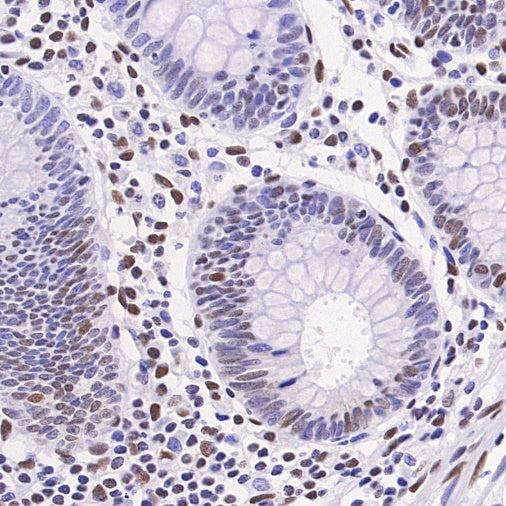 Phospho-ATF-2 (Thr71)/ATF-7 (Thr53) Recombinant Rabbit mAb (S-3535)