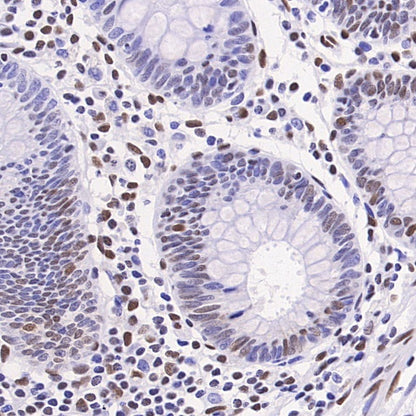 Phospho-ATF-2 (Thr71)/ATF-7 (Thr53) Recombinant Rabbit mAb (S-3535)