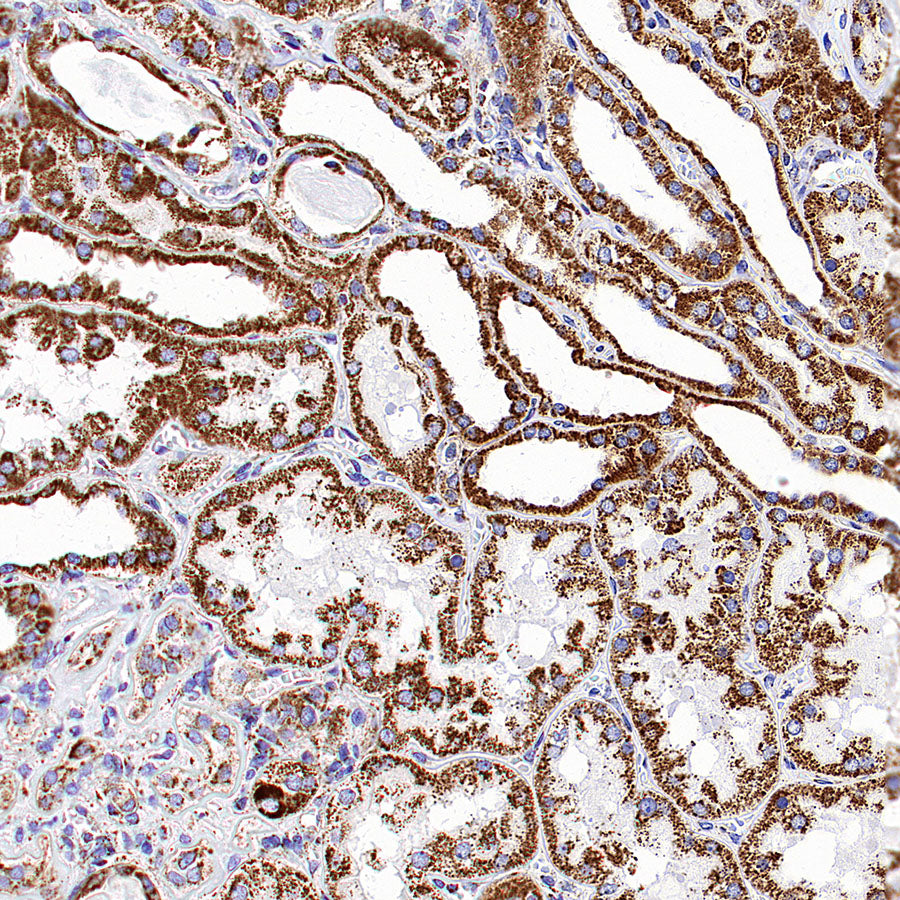 CLPP Recombinant Rabbit mAb (S-4169-31)