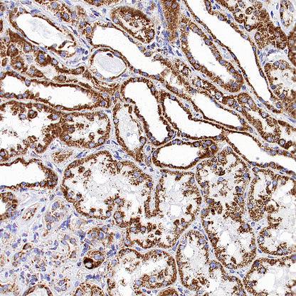 CLPP Recombinant Rabbit mAb (S-4169-31)