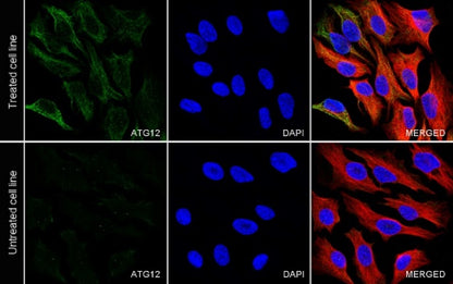 ATG12 Recombinant Rabbit mAb (S-1143-209)