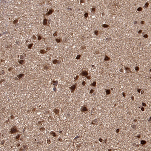 VCP Recombinant Rabbit mAb (S-1818-121)