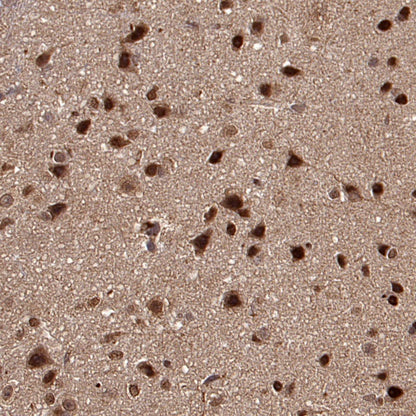 VCP Recombinant Rabbit mAb (S-1818-121)
