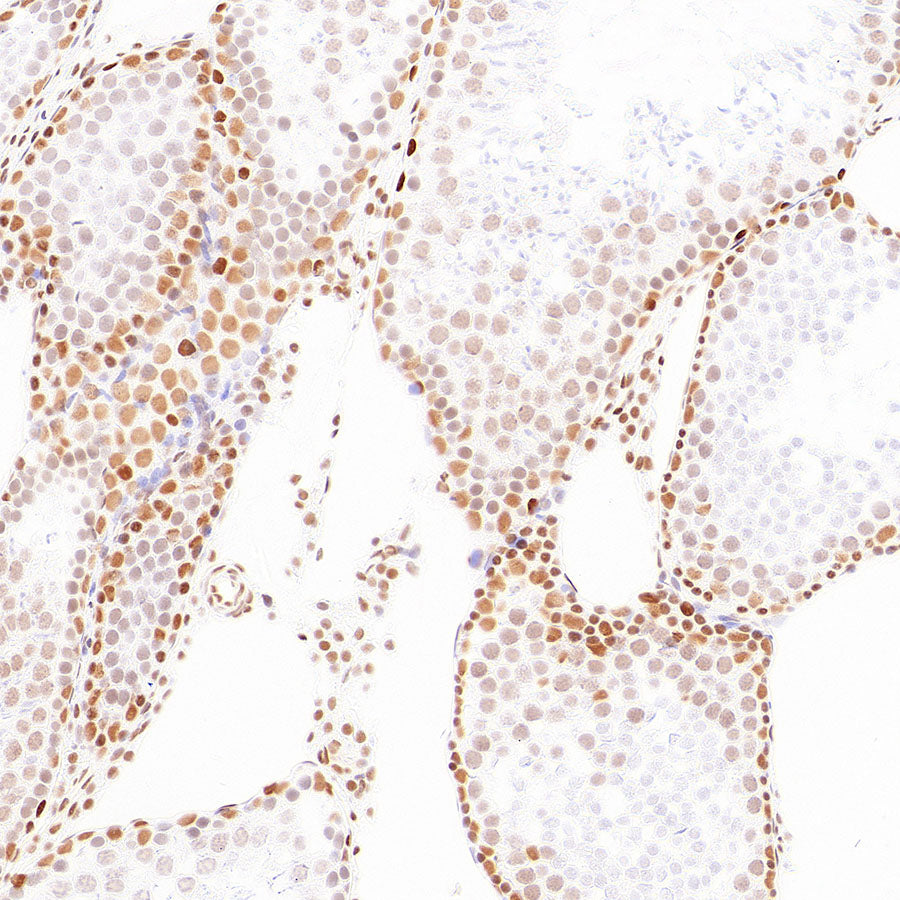 pan Brd4 Recombinant Rabbit mAb (S-6208)
