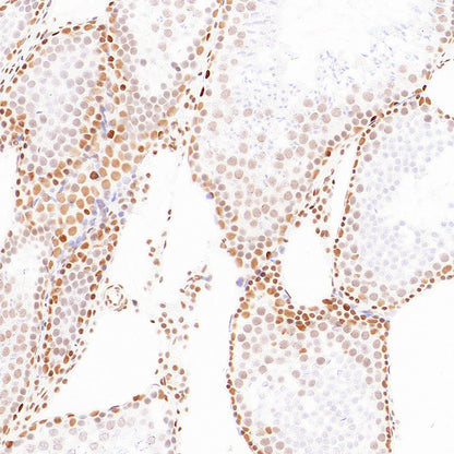 pan Brd4 Recombinant Rabbit mAb (S-6208)