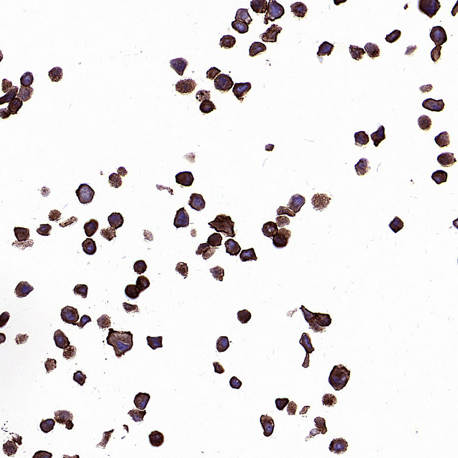 PTK7 Recombinant Rabbit mAb ,PBS Only(SDT-2432-156)