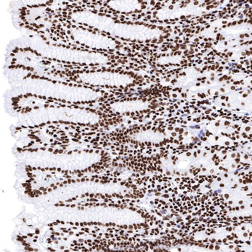 Histone H3 (mono methyl K36) Recombinant Rabbit mAb (S-R396)