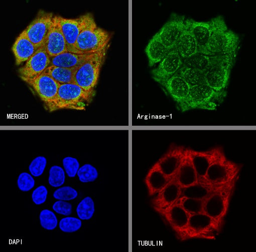 Arginase-1 Recombinant Rabbit mAb (SDT-369-33)