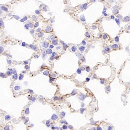 CD105 Recombinant Rabbit mAb (S-3764-11)