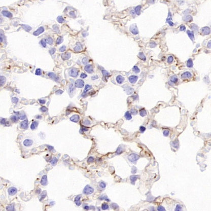 CD105 Recombinant Rabbit mAb (S-3764-11)