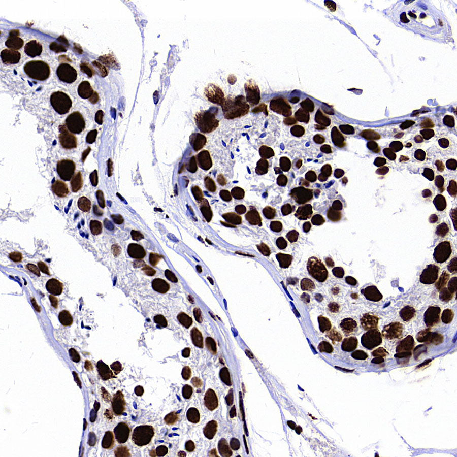 ZMYND8 Recombinant Rabbit mAb (S-5407)