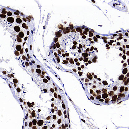 ZMYND8 Recombinant Rabbit mAb (S-5407)
