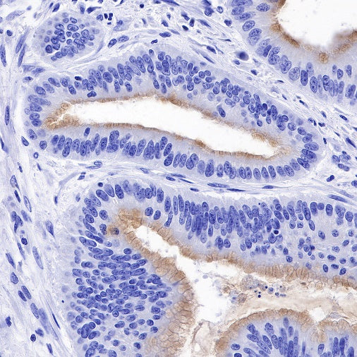 MUC2 Recombinant Rabbit mAb (SDT-345-9)