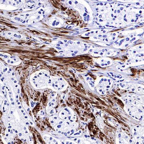 Calponin-1 Recombinant Rabbit mAb (S-R161)
