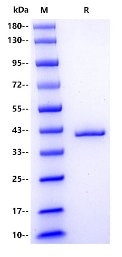 Human CCL4 Protein, hFc tag