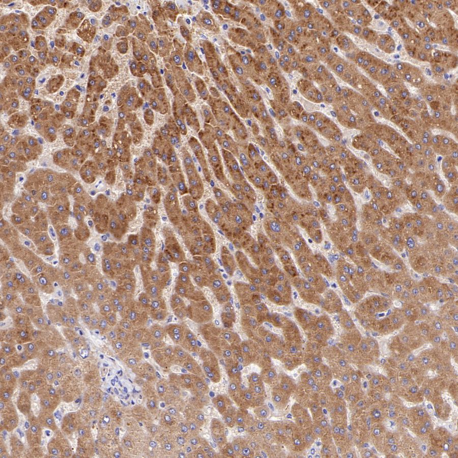 eEF2 Recombinant Rabbit mAb (S-1976-35)