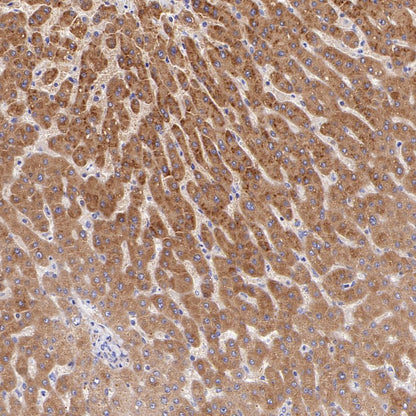 eEF2 Recombinant Rabbit mAb (S-1976-35)