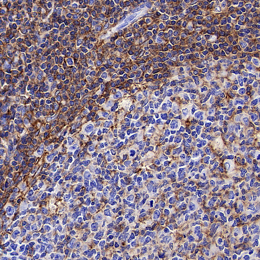 CD44 Rabbit Polyclonal Antibody