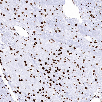 MeCP2 Recombinant Rabbit mAb (S-1884-28)