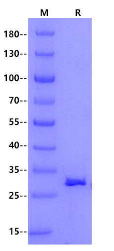 NNMT His Tag Protein, Mouse
