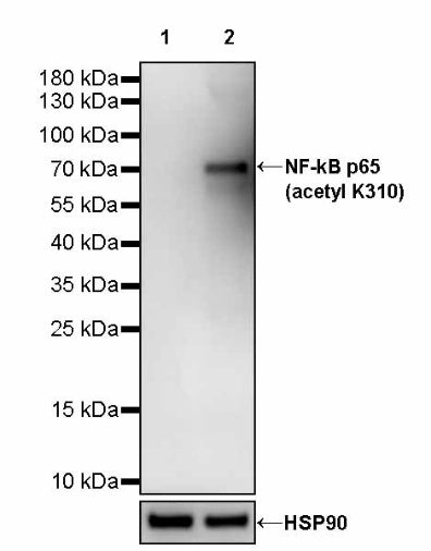 NF-kB p65 (acetyl K310) Recombinant Rabbit mAb (S-1113-161)