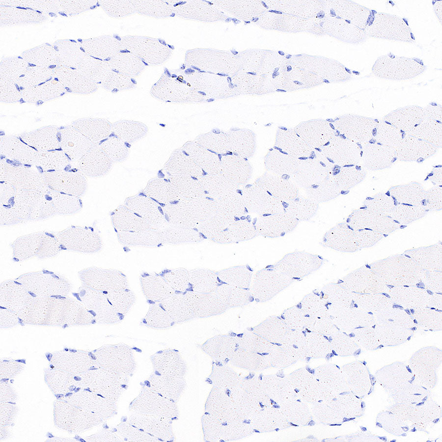 H+/K+-ATPase Recombinant Rabbit mAb (S-3474-110)
