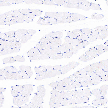 H+/K+-ATPase Recombinant Rabbit mAb (S-3474-110)