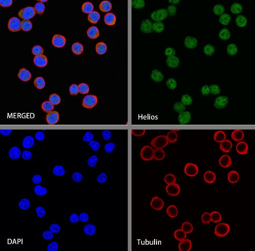 Helios Recombinant Rabbit mAb (S-1299-31)