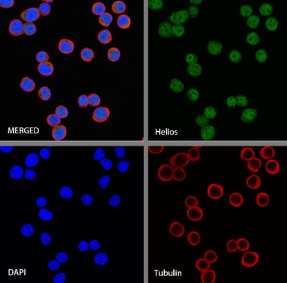 Helios Recombinant Rabbit mAb (S-1299-31)