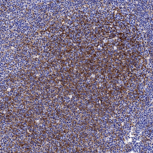 ICAM-1/CD54 Recombinant Rabbit mAb (S-906-48)