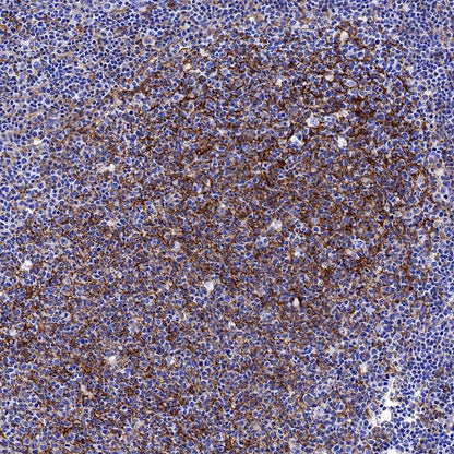 ICAM-1/CD54 Recombinant Rabbit mAb (S-906-48)