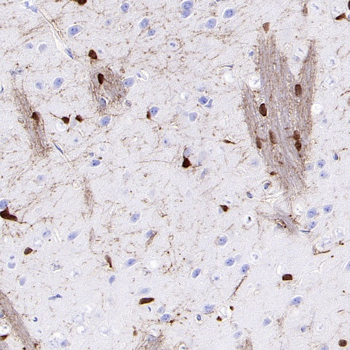 CA2 Rabbit Polyclonal Antibody