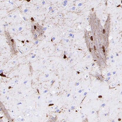 CA2 Rabbit Polyclonal Antibody