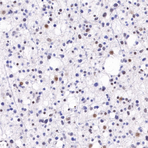 S-RMab® ATRX Recombinant Rabbit mAb (SDT-458-37)