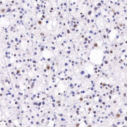 S-RMab® ATRX Recombinant Rabbit mAb (SDT-458-37)