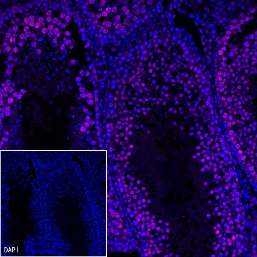 RNA polymerase II CTD repeat YSPTSPS (phosphor S2) Recombinant Rat mAb (S-R199)