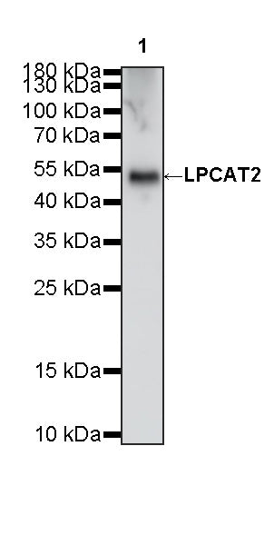 LPCAT2 Recombinant Rabbit mAb (S-4239-18)