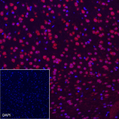 MSH6 Recombinant Rabbit mAb (Alexa Fluor® 555 Conjugate) (SDT-R094)
