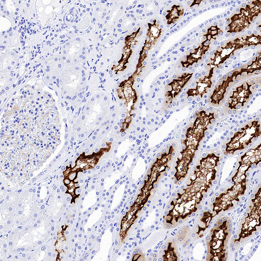 SLC5A1/SGLT1 Recombinant Rabbit mAb (S-4122-30)