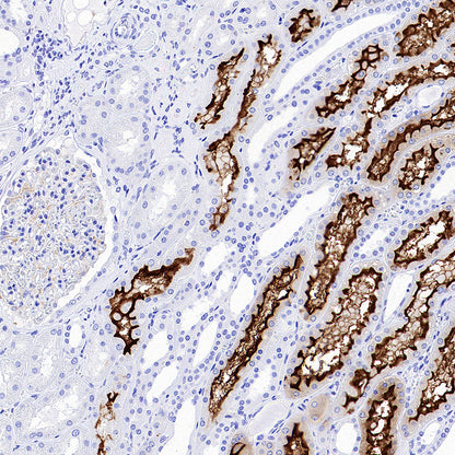 SLC5A1/SGLT1 Recombinant Rabbit mAb (S-4122-30)