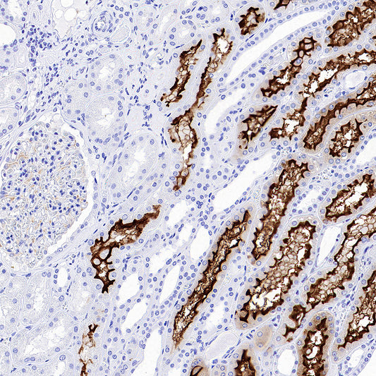 SLC5A1/SGLT1 Recombinant Rabbit mAb (S-4122-30)