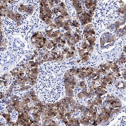 Glypican-3 Recombinant Rabbit mAb (SDT-4064-69)