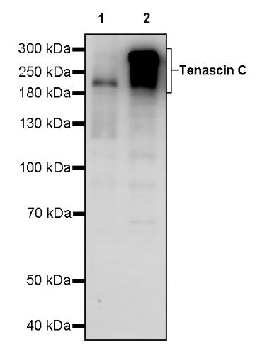Tenascin C Recombinant Rabbit mAb (S-775-274)
